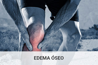edema-oseo-c