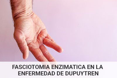 fasciotomia-enzimatica-c