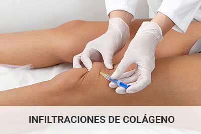 infiltraciones-colageno-c