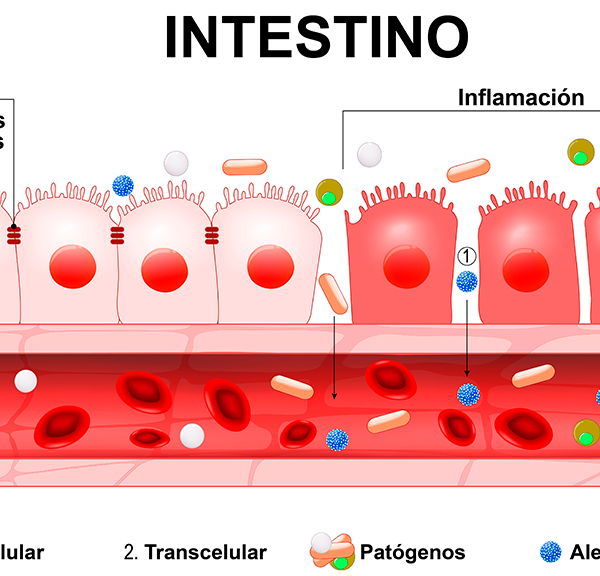 Intestino celíaco - Clínica Luis Baños