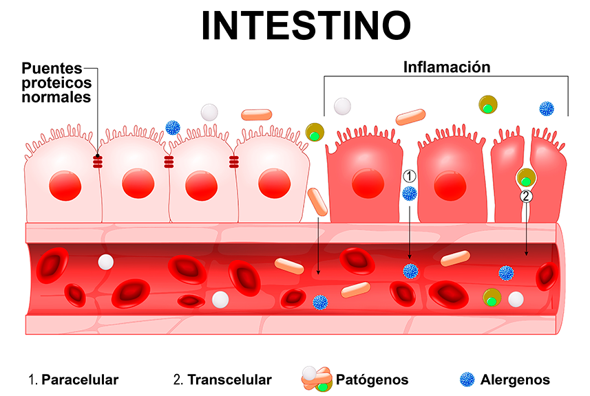 Intestino celíaco - Clínica Luis Baños