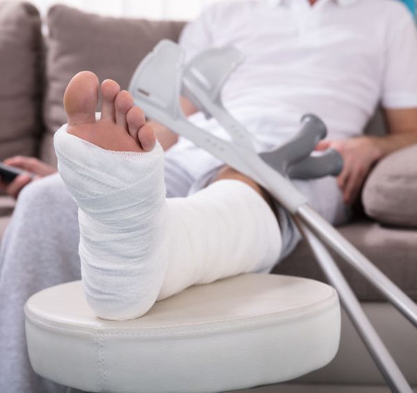 Fotografía que muestra un hombre escayolado, sentado en el sofá, tras sufrir una fractura en la pierna