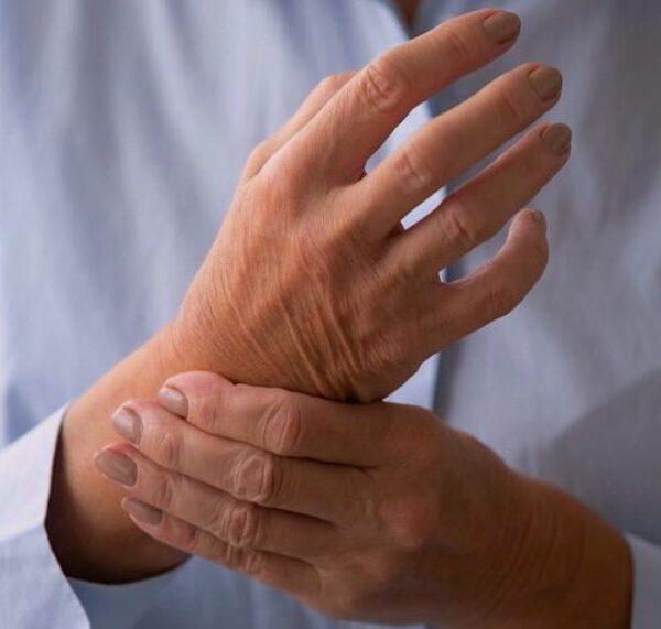 artritis y artrosis