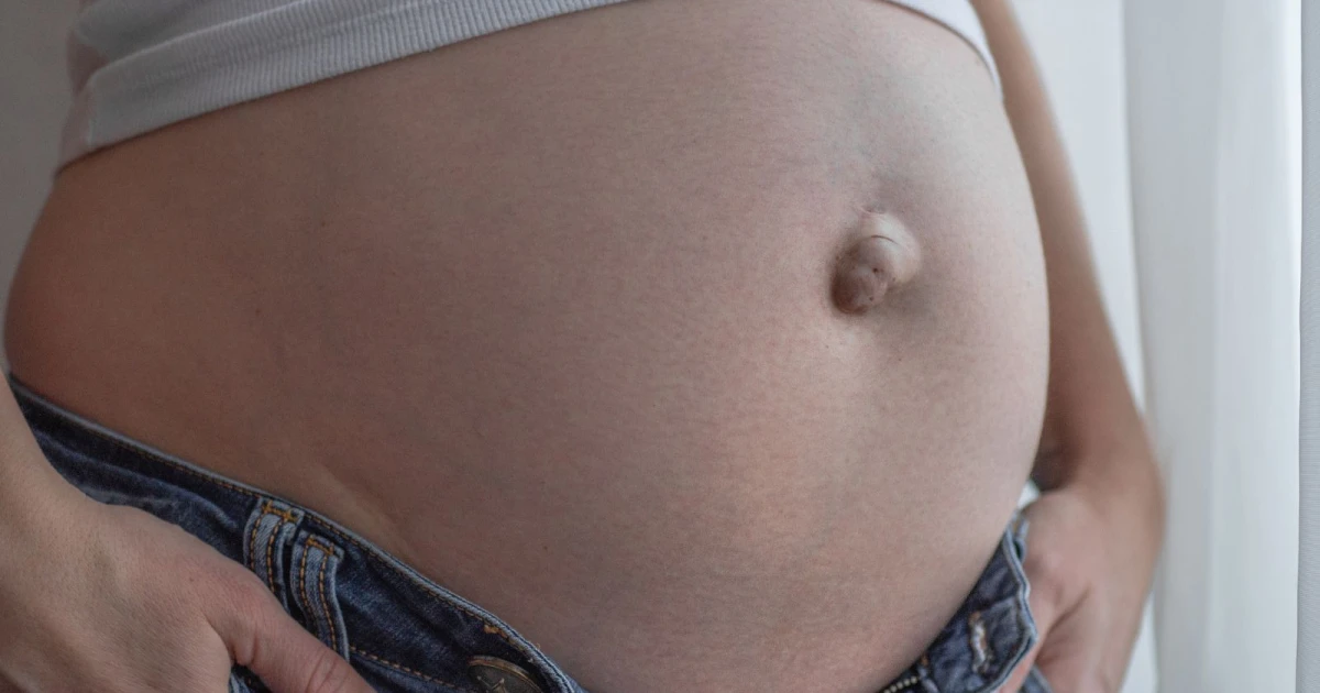 tipo de hernias en mujeres